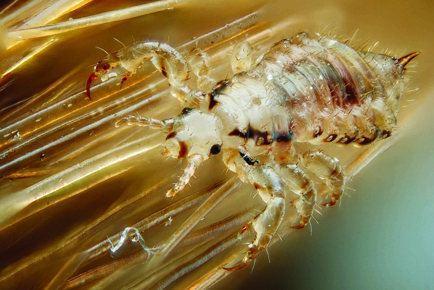 Dealing With Lice: A Local Resource Guide - NW Kids Magazine